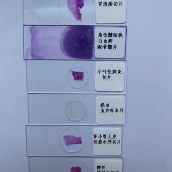 病理切片厂家**高质量生物切片基础**专用产品显微镜下玻片大叶性肺炎